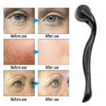 Derma Roller for Hair Growth & Smooth Skin  and remove Therapy